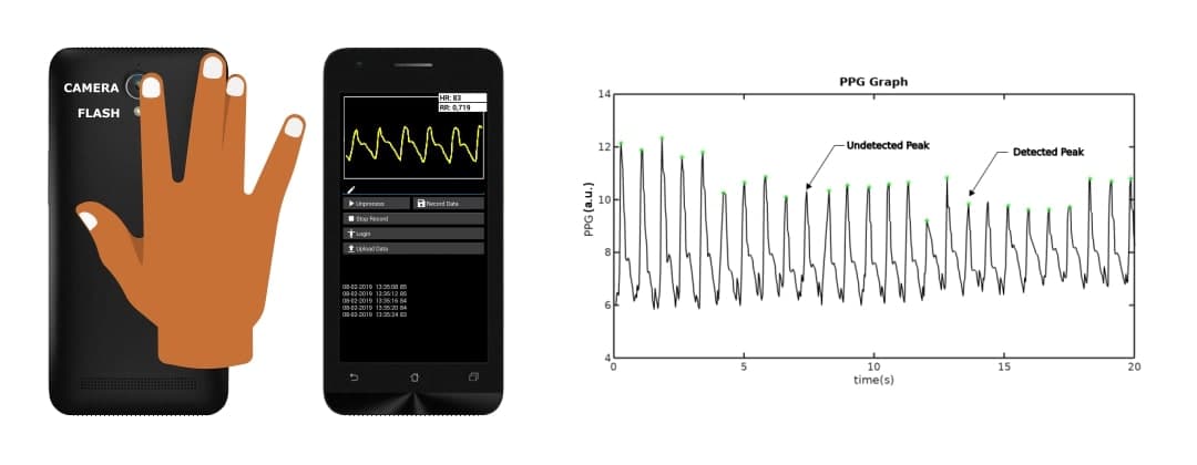 Photoplethysmogram (PPG) Signal Acquisition, Peak Detection, and Heart Rate Calculation Using Smartphone Camera